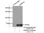 PODXL2 Antibody in Immunoprecipitation (IP)