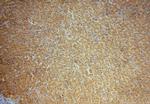 CSNK1G1 Antibody in Immunohistochemistry (Paraffin) (IHC (P))