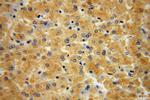 CSNK1G1 Antibody in Immunohistochemistry (Paraffin) (IHC (P))
