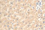 CSNK1G1 Antibody in Immunohistochemistry (Paraffin) (IHC (P))
