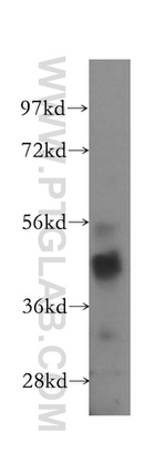 CSNK1G1 Antibody in Western Blot (WB)