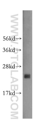RPL23A Antibody in Western Blot (WB)