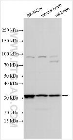 HYI Antibody in Western Blot (WB)