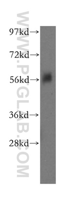 BANP Antibody in Western Blot (WB)