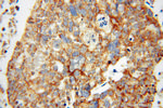 MRPL44 Antibody in Immunohistochemistry (Paraffin) (IHC (P))
