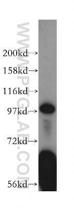 MOCOS Antibody in Western Blot (WB)