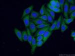 NRF2/NFE2L2 Antibody in Immunocytochemistry (ICC/IF)