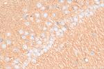 SNCG Antibody in Immunohistochemistry (Paraffin) (IHC (P))