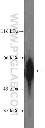 NFIC Antibody in Western Blot (WB)