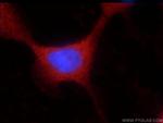 UBQLNL Antibody in Immunocytochemistry (ICC/IF)