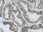 UBQLNL Antibody in Immunohistochemistry (Paraffin) (IHC (P))