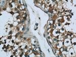 UBQLNL Antibody in Immunohistochemistry (Paraffin) (IHC (P))