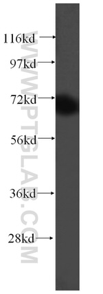 UBQLNL Antibody in Western Blot (WB)