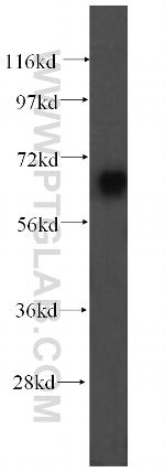 UBQLNL Antibody in Western Blot (WB)