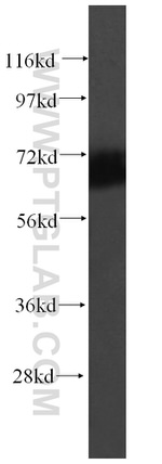 UBQLNL Antibody in Western Blot (WB)