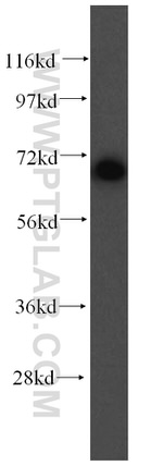 UBQLNL Antibody in Western Blot (WB)
