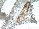 Biglycan Antibody in Immunohistochemistry (Paraffin) (IHC (P))