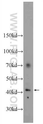Biglycan Antibody in Western Blot (WB)