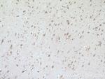 CERCAM Antibody in Immunohistochemistry (Paraffin) (IHC (P))