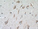 CERCAM Antibody in Immunohistochemistry (Paraffin) (IHC (P))