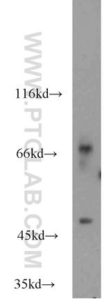 CERCAM Antibody in Western Blot (WB)
