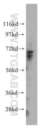 CERCAM Antibody in Western Blot (WB)
