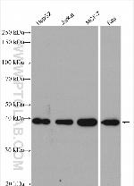 BCAT2 Antibody in Western Blot (WB)