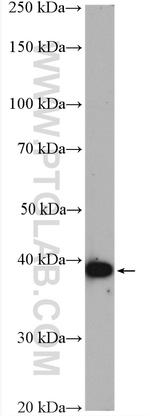 BCAT2 Antibody in Western Blot (WB)