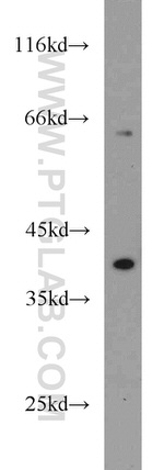 BCAT2 Antibody in Western Blot (WB)