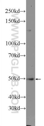 NLE1 Antibody in Western Blot (WB)