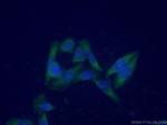 ENO3 Antibody in Immunocytochemistry (ICC/IF)