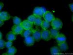 RNASE6 Antibody in Immunocytochemistry (ICC/IF)