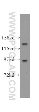 PAN2 Antibody in Western Blot (WB)