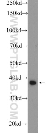 MRPS5 Antibody in Western Blot (WB)