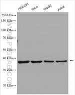 MRPS5 Antibody in Western Blot (WB)