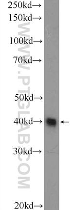 MRPS5 Antibody in Western Blot (WB)