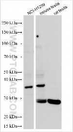 STYXL1 Antibody in Western Blot (WB)