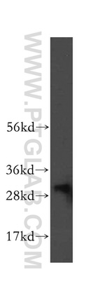 NIT2 Antibody in Western Blot (WB)