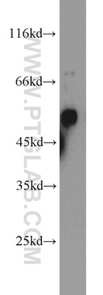 Carboxypeptidase M Antibody in Western Blot (WB)