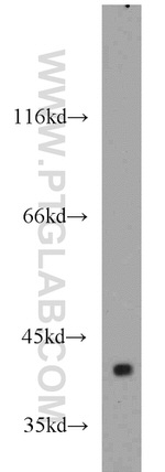 ERK1/2 Antibody in Western Blot (WB)