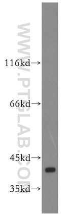 ERK1/2 Antibody in Western Blot (WB)