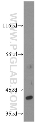 ERK1/2 Antibody in Western Blot (WB)