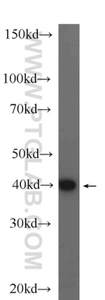 ERK1/2 Antibody in Western Blot (WB)