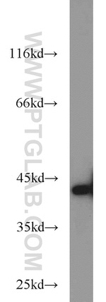 ERK1/2 Antibody in Western Blot (WB)