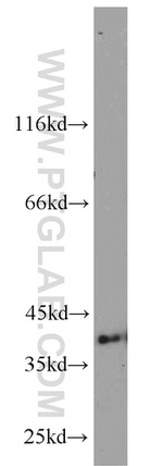 ERK1/2 Antibody in Western Blot (WB)