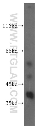 ERK1/2 Antibody in Western Blot (WB)