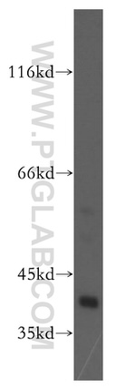 ERK1/2 Antibody in Western Blot (WB)