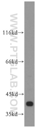 ERK1/2 Antibody in Western Blot (WB)
