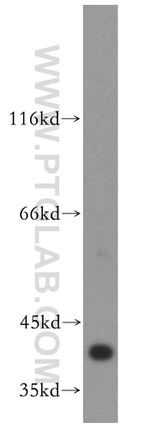 ERK1/2 Antibody in Western Blot (WB)