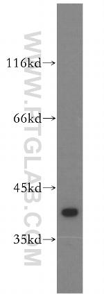 ERK1/2 Antibody in Western Blot (WB)